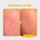 PURE VITAMIN C 24% SERUM 30ml