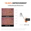 Carrotene IPMP¢â Hydromelt Cleansing Balm