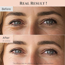 Revive Eye Serum 30ml / 1 fl. oz.